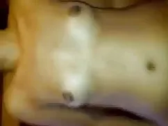 মুখের ব্রণ রাজকুমারী ...